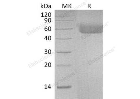 Recombinant Human IL1R1/CD121a Protein