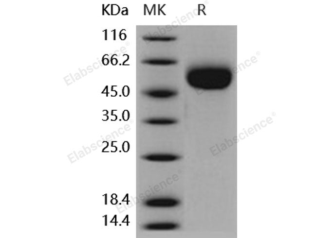 Recombinant Human IL1R2/CD121b Protein (His Tag)(Active)