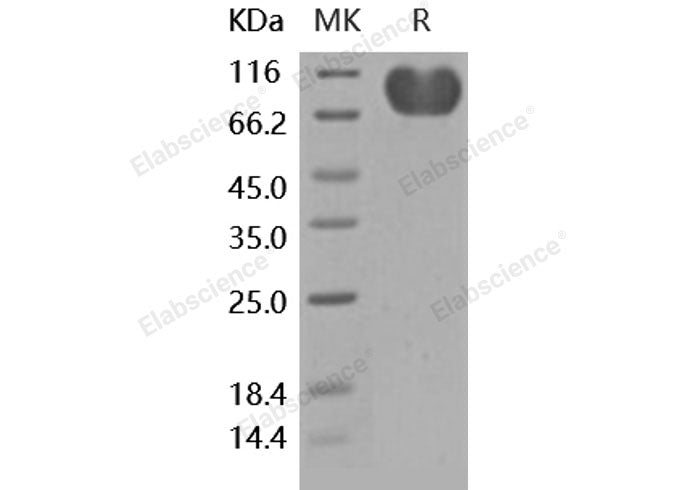 Recombinant Human CD155/PVR Protein (Fc Tag)(Active)