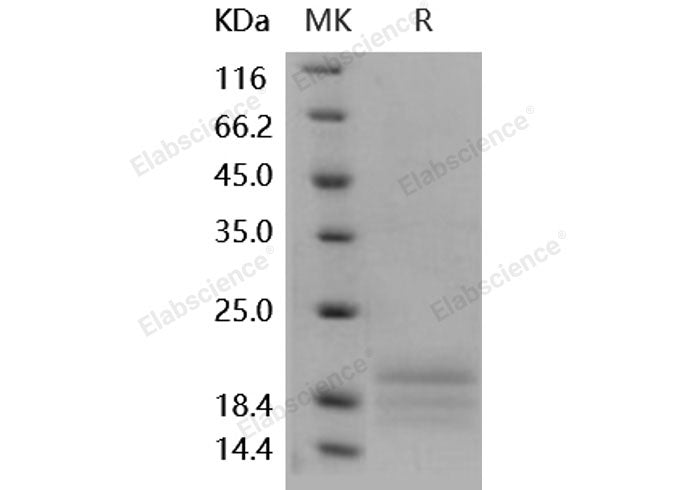 Recombinant Human AgRP/AGRP Protein (His Tag)