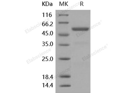 Recombinant Human Carboxypeptidase E/CPE Protein (His Tag)(Active)