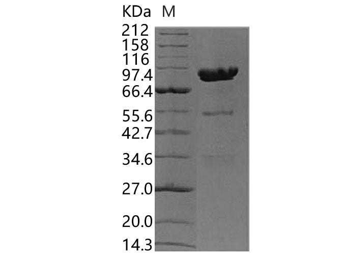 Recombinant Human Carboxypeptidase E/CPE Protein (Fc Tag)