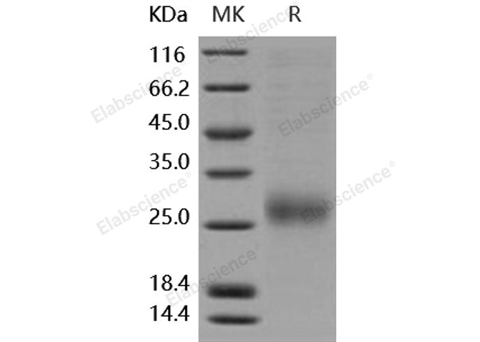 Recombinant Human ALK-1/ACVRL1 Protein (His Tag)(Active)