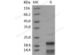Recombinant Human CASP7/caspase 7 Protein (His Tag)