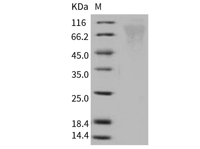 Recombinant Human Respiratory Syncytial Virus (RSV) (A, rsb1734) Glycoprotein G/RSV-G Protein (93% Homology) (His Tag)