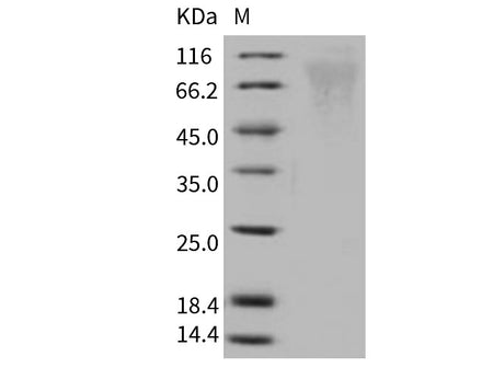 Recombinant Human Respiratory Syncytial Virus (RSV) (A, rsb1734) Glycoprotein G/RSV-G Protein (93% Homology) (His Tag)