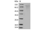 Recombinant Human Respiratory Syncytial Virus (RSV) (A, rsb1734) Glycoprotein G/RSV-G Protein (93% Homology) (His Tag)