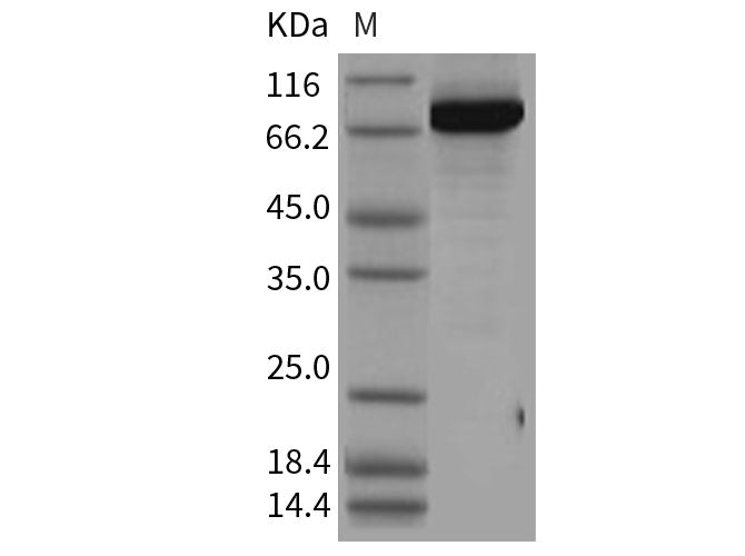 Recombinant Human PBEF/NAMPT Protein (His & GST Tag)