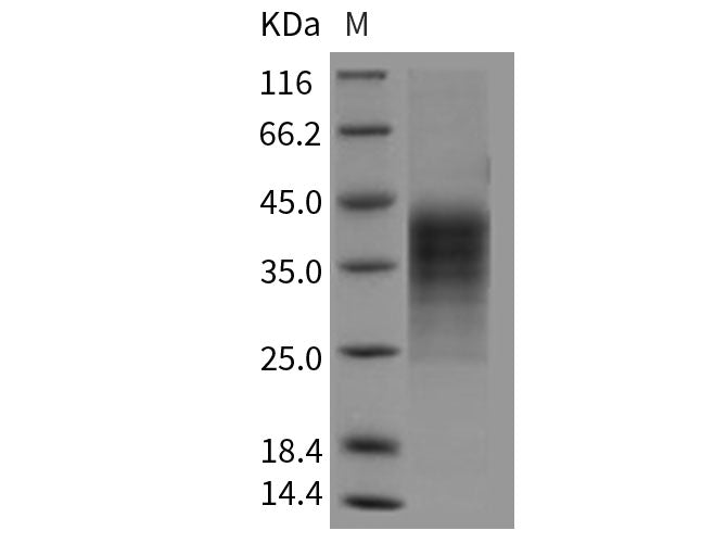 Recombinant Human LIF Protein (His Tag)(Active)