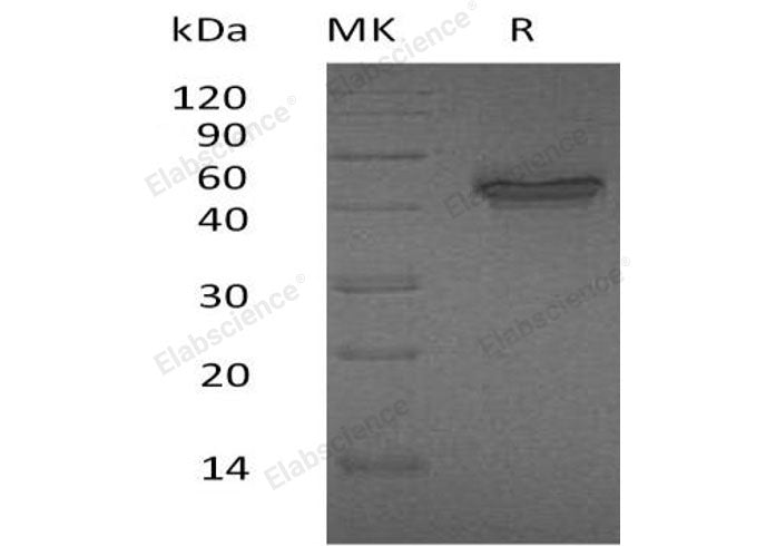 Recombinant Human IL-12 p40/IL-12B Protein