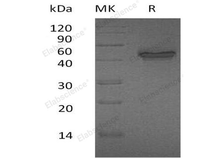 Recombinant Human IL-12 p40/IL-12B Protein