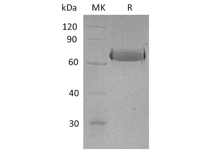 Recombinant Human EphA2 Protein (His Tag)(Active)
