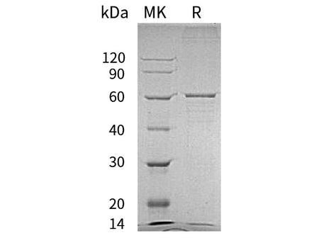 Recombinant Human BLK Protein (His Tag)