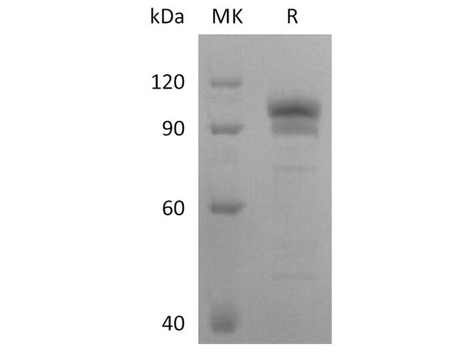 Recombinant Human EphB2 Protein (Fc Tag)(Active)
