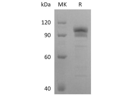 Recombinant Human EphB2 Protein (Fc Tag)(Active)