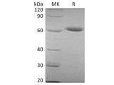 Recombinant Human CD73/NT5E Protein (His Tag)(Active)