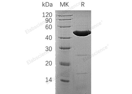 Recombinant Human ACADM/MCAD Protein (His Tag)