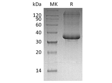 Recombinant Human SP-10/ACRV1 Protein (His Tag)