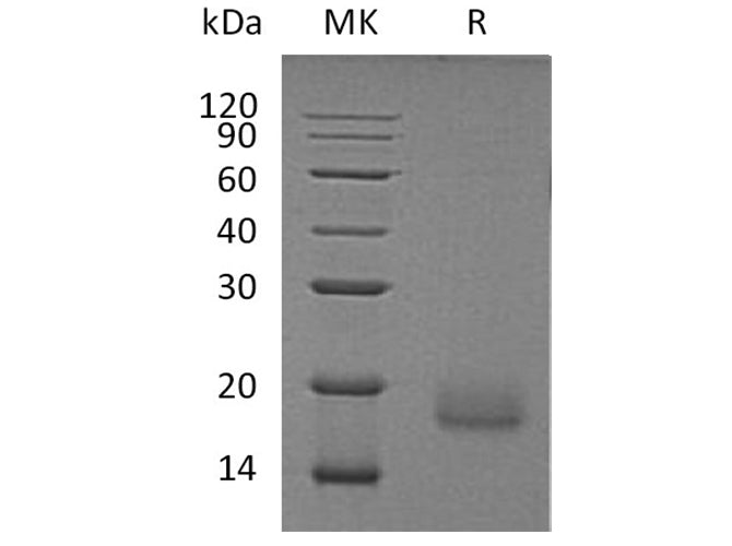 Recombinant Human ALK-2/ACVR1 Protein (Human Cells, His Tag)