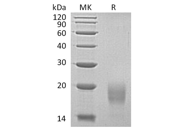 Recombinant Human ALK4/ACVR1B Protein (His Tag)(Active)