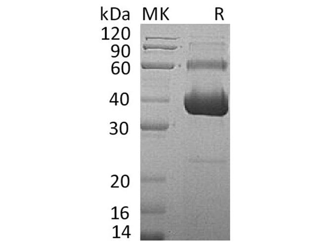 Recombinant Human Activin RIIA/ACVR2A Protein (Fc & His Tag)(Active)