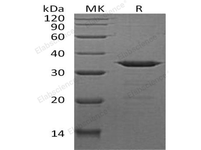 Recombinant Human NECAP2 Protein (His Tag)