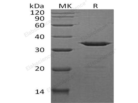 Recombinant Human NECAP2 Protein (His Tag)