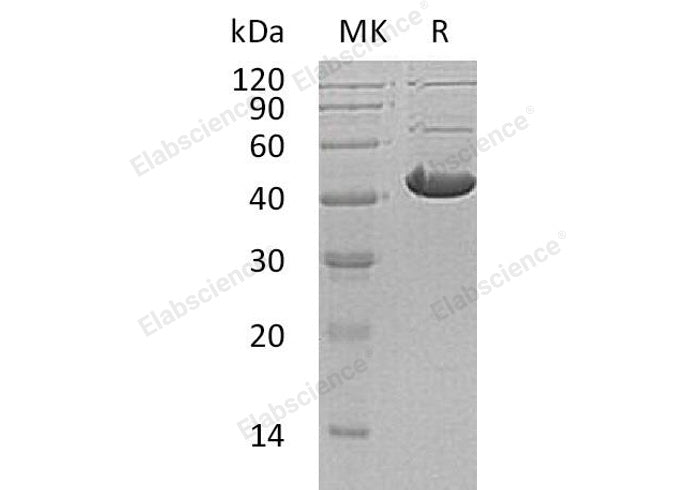 Recombinant Human ADH7 Protein (His Tag)