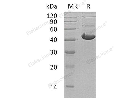 Recombinant Human ADH7 Protein (His Tag)