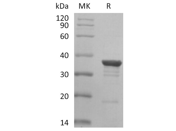 Recombinant Human AKR1C2 Protein