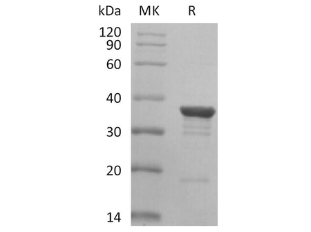 Recombinant Human AKR1C2 Protein