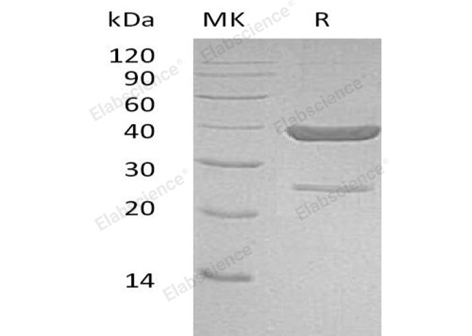 Recombinant Human AKR1C4 Protein (His Tag)