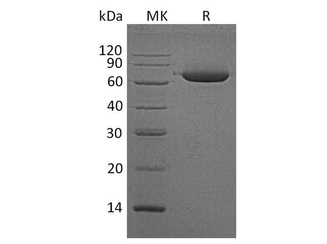 Recombinant Human Alkaline Phosphatase/ALPL Protein (His Tag)