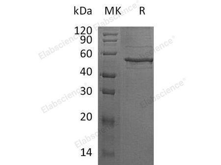 Recombinant Human ANGPTL8/β-trophin Protein (Fc Tag)