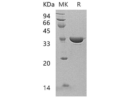 Recombinant Human Annexin A13/ANXA13 Protein