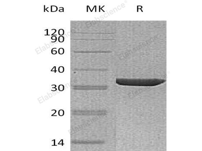 Recombinant Human Annexin A3/ANXA3 Protein