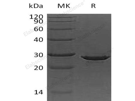 Recombinant Human Apolipoprotein A-I/ApoAI Protein (His Tag, E. coli)