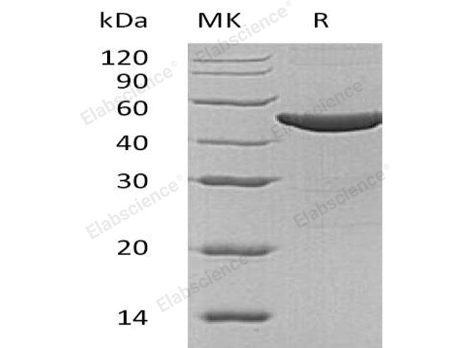 Recombinant Human ASS1 Protein (His Tag)