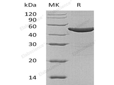 Recombinant Human ASS1 Protein (His Tag)