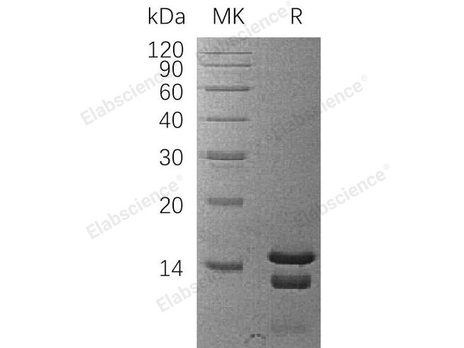 Recombinant Human Astrocytic Phosphoprotein PEA-15/PEA15 Protein