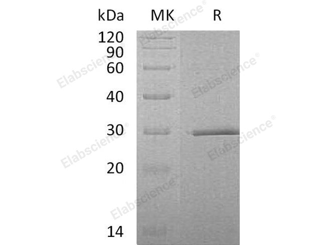 Recombinant Human SWSAP1 Protein (His Tag)