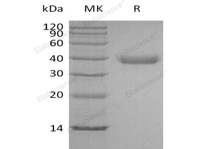 Recombinant Human Azurocidin/CAP37 Protein (His Tag)
