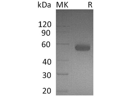 Recombinant Human BTLA/CD272 Protein (Fc Tag)(Active)