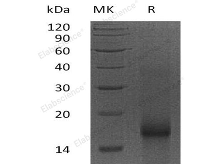 Recombinant Human Survivin/BIRC5 Protein