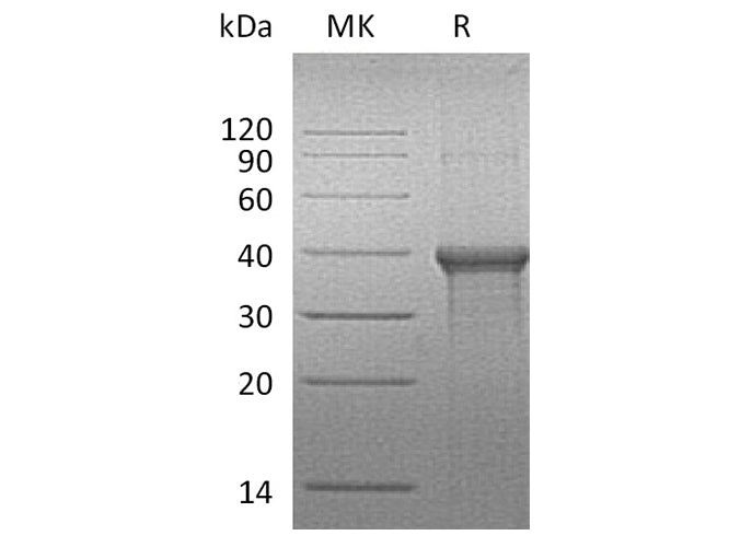Recombinant Human BLVRA Protein (His Tag)