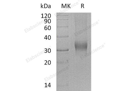 Recombinant Human PRG2/BMPG Protein (His Tag)