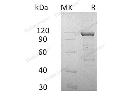 Recombinant Human Cadherin-11/CDH11 Protein (Fc & His Tag)