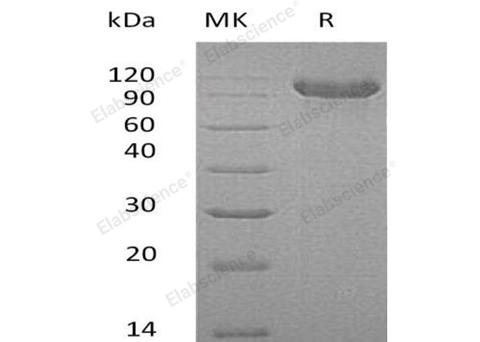 Recombinant Human Cadherin-16/CDH16 Protein (His Tag)