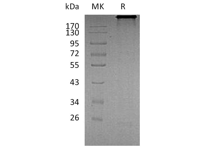 Recombinant Human Cadherin-6/CDH6 Protein (Fc Tag)