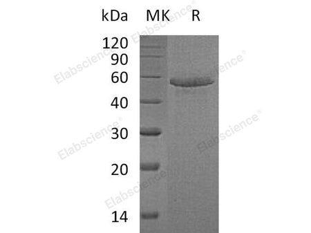 Recombinant Human Calmegin/CLGN Protein (His Tag)